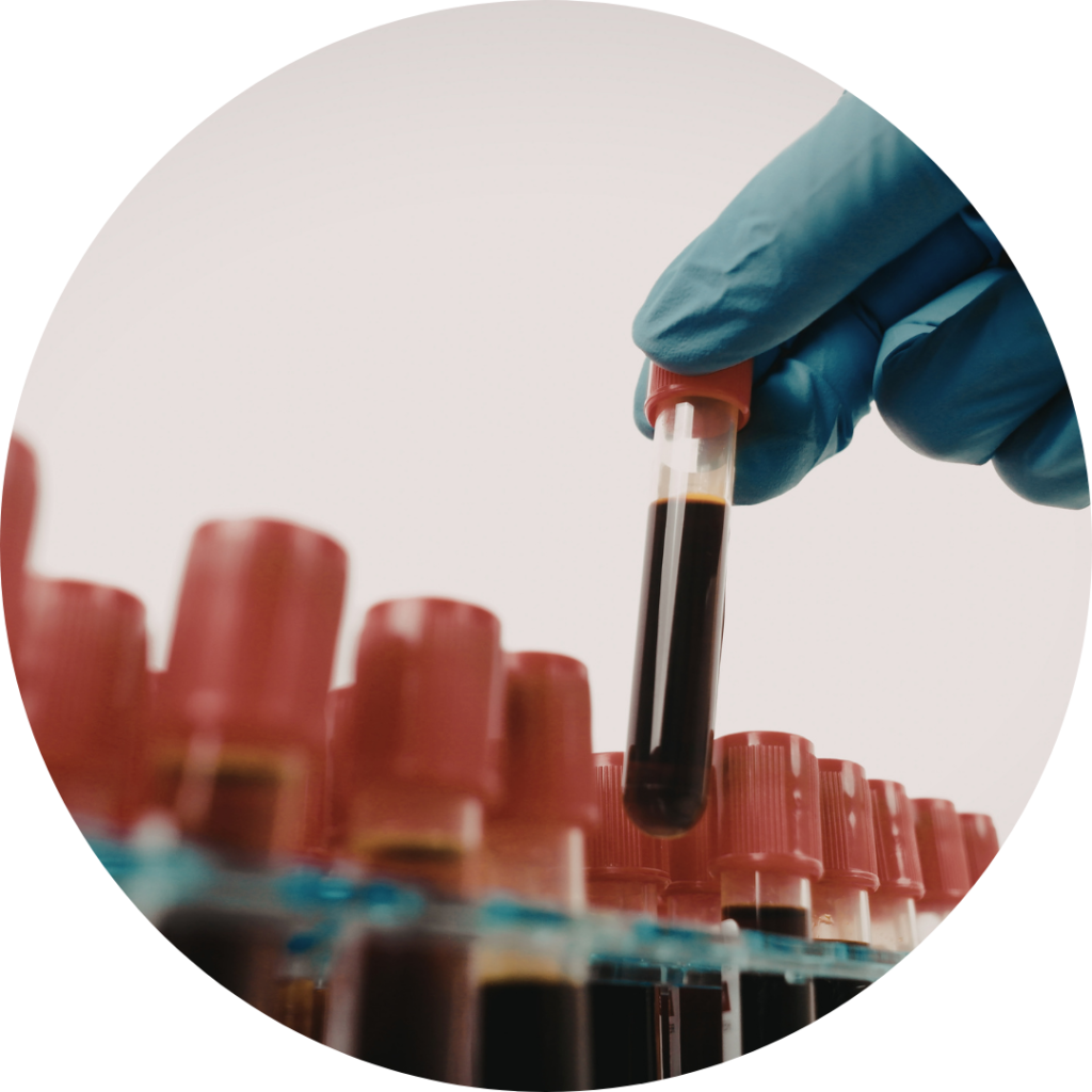 Laboratorio clínico y análisis de sangre en Casley Medical, Zapopan