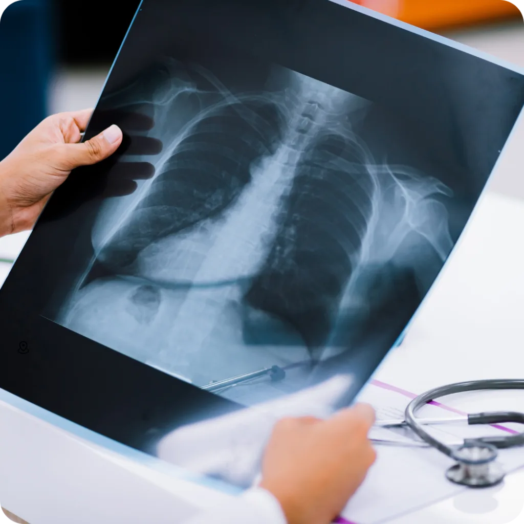 Radiografías y rayos X digitales en Casley Medical, Zapopan